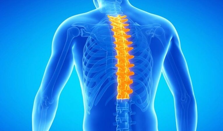 Osteochondróza hrudnej chrbtice