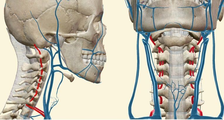 Vaskulárny syndróm pri osteochondróze