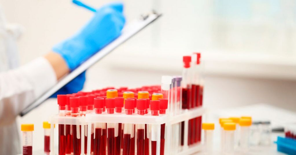 Vykonanie krvného testu na detekciu zápalu