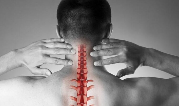 Výrazná bolesť neurologického syndrómu